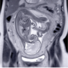 UCSF ObGyn Women’s Imaging 2025 (Videos + Slides PDFs)