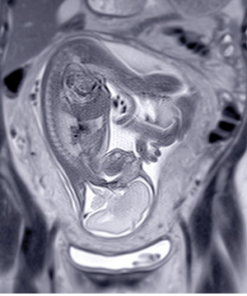 UCSF ObGyn Women’s Imaging 2025 (Videos + Slides PDFs)