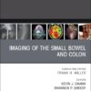 Imaging of the Small Bowel and Colon, An Issue of Radiologic Clinics of North America (Volume 63-3) (The Clinics: Radiology, Volume 63-3) (True PDF)