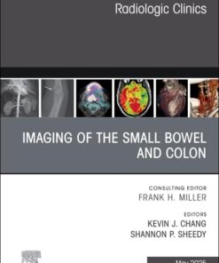 Imaging of the Small Bowel and Colon, An Issue of Radiologic Clinics of North America (Volume 63-3) (The Clinics: Radiology, Volume 63-3) (True PDF)