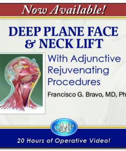 Quality Medical Publishing Deep Plane Face & Neck Lift With Adjunctive Rejuvenating Procedures 2025
