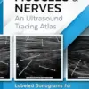 TECHNICAL ULTRASOUND HANDBOOK – MUSCLES & NERVES: An Ultrasound Tracing Atlas (Series 1) (PDF)