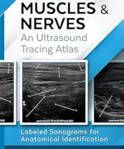 TECHNICAL ULTRASOUND HANDBOOK – MUSCLES & NERVES: An Ultrasound Tracing Atlas (Series 1) (PDF)