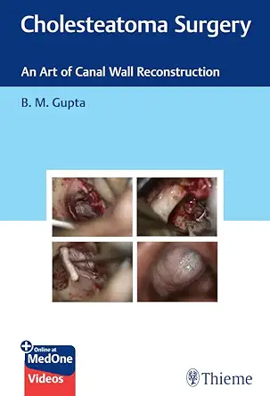 Cholesteatoma Surgery: An Art of Canal Wall Reconstruction (Original PDF from Publisher+Videos) Cholesteatoma Surgery: An Art of Canal Wall Reconstruction (Original PDF from Publisher+Videos)