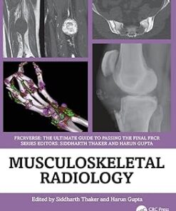 Musculoskeletal Radiology: An Ultimate Guide to Passing the Final FRCR (FRCRverse) (PDF)