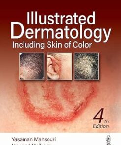 Illustrated Dermatology Including Skin of Color, 4th edition (EPUB)