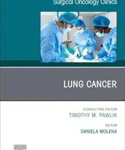 Lung Cancer, An Issue of Surgical Oncology Clinics of North America (Volume 34-4) (The Clinics: Surgery, Volume 34-4) (EPUB)