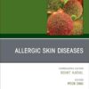 Allergic Skin Diseases, An Issue of Immunology and Allergy Clinics of North America (Volume 45-4) (EPUB)