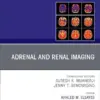 Adrenal and Renal Imaging, An Issue of Magnetic Resonance Imaging Clinics of North America (Volume 33-4) (The Clinics: Radiology, Volume 33-4) (EPUB)