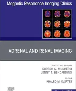 Adrenal and Renal Imaging, An Issue of Magnetic Resonance Imaging Clinics of North America (Volume 33-4) (The Clinics: Radiology, Volume 33-4) (EPUB)