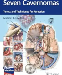 Seven Cavernomas: Tenets and Techniques for Resection (Videos Only)