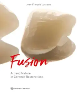 Fusion: Art and Nature in Ceramic Restorations (EPUB)