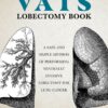 The VATS Lobectomy Book (PDF)