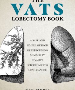 The VATS Lobectomy Book (PDF)