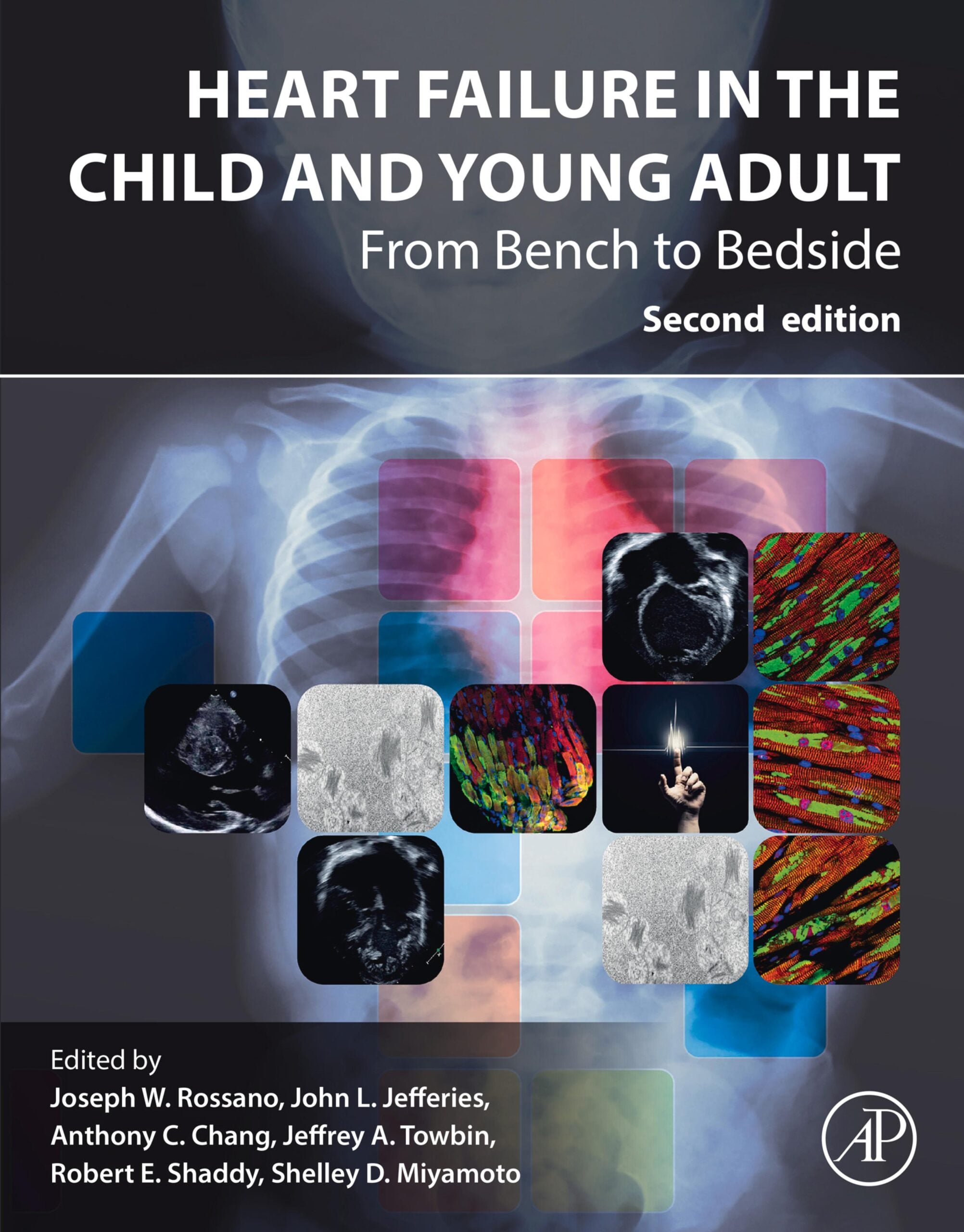 Heart Failure in the Child and Young Adult, 2nd Edition(PDF)