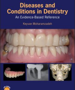 Diseases and Conditions in Dentistry (EPUB)