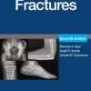 Handbook of Fractures, 7th Edition (EPUB)