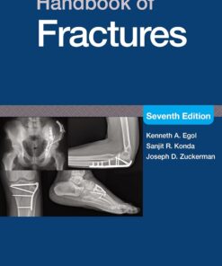 Handbook of Fractures, 7th Edition (EPUB)