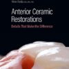 Anterior Ceramic Restorations: Details That Make the Difference (EPUB)