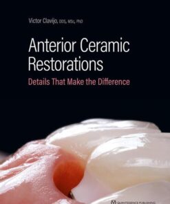 Anterior Ceramic Restorations: Details That Make the Difference (EPUB)