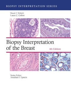 Biopsy Interpretation of the Breast (Biopsy Interpretation Series), 4th Edition (EPUB)
