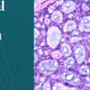 Harvard 46th Annual Current Concepts in Surgical Pathology 2025 Harvard 46th Annual Current Concepts in Surgical Pathology 2025