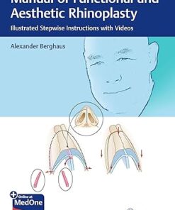 Manual of Functional and Aesthetic Rhinoplasty: Illustrated Stepwise Instructions with Videos (PDF+ VIDEO)