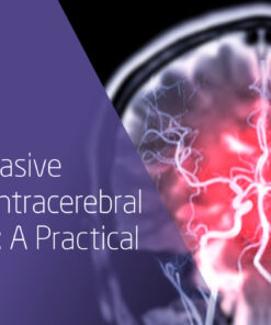 Northwestern Medicine Minimally Invasive Surgery for Intracerebral Hemorrhage A Practical Workshop 2025