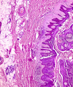 Oakstone Dermatopathology 2025