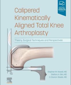 Calipered Kinematically aligned Total Knee Arthroplasty: Theory, Surgical Techniques and Perspectives (Videos Only)