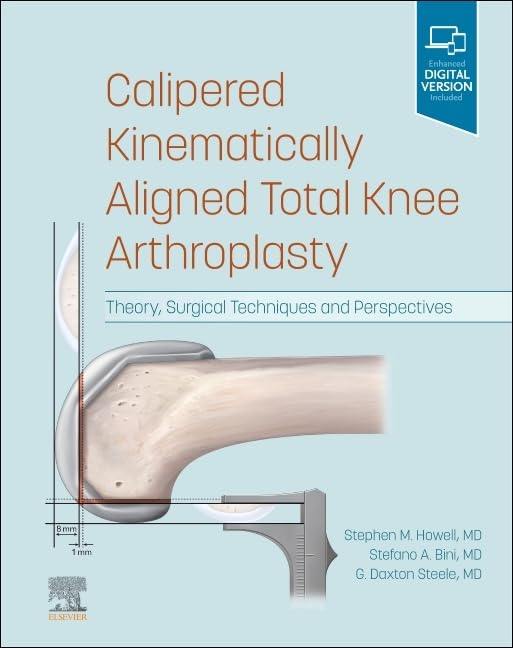 Calipered Kinematically aligned Total Knee Arthroplasty: Theory, Surgical Techniques and Perspectives (Videos Only) Calipered Kinematically aligned Total Knee Arthroplasty: Theory, Surgical Techniques and Perspectives (Videos Only)