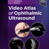 Video Atlas of Ophthalmic Ultrasound (True PDF)