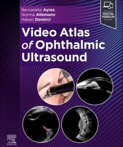 Video Atlas of Ophthalmic Ultrasound (True PDF)