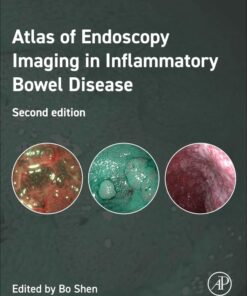 Atlas of Endoscopy Imaging in Inflammatory Bowel Disease, 2nd edition(PDF)