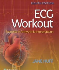 ECG Workout: Exercises in Arrhythmia Interpretation, 8th edition (PDF)