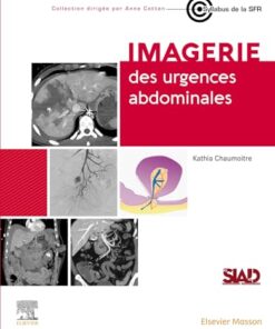 Imagerie des urgences abdominales (True PDF)