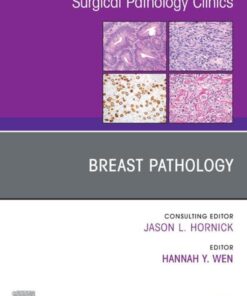 Breast Pathology, An Issue of Surgical Pathology Clinics (EPUB)