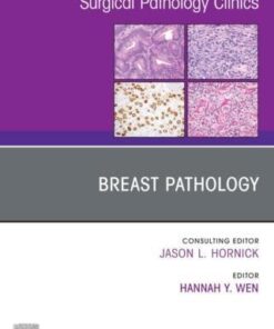 Breast Pathology, An Issue of Surgical Pathology Clinics (PDF)