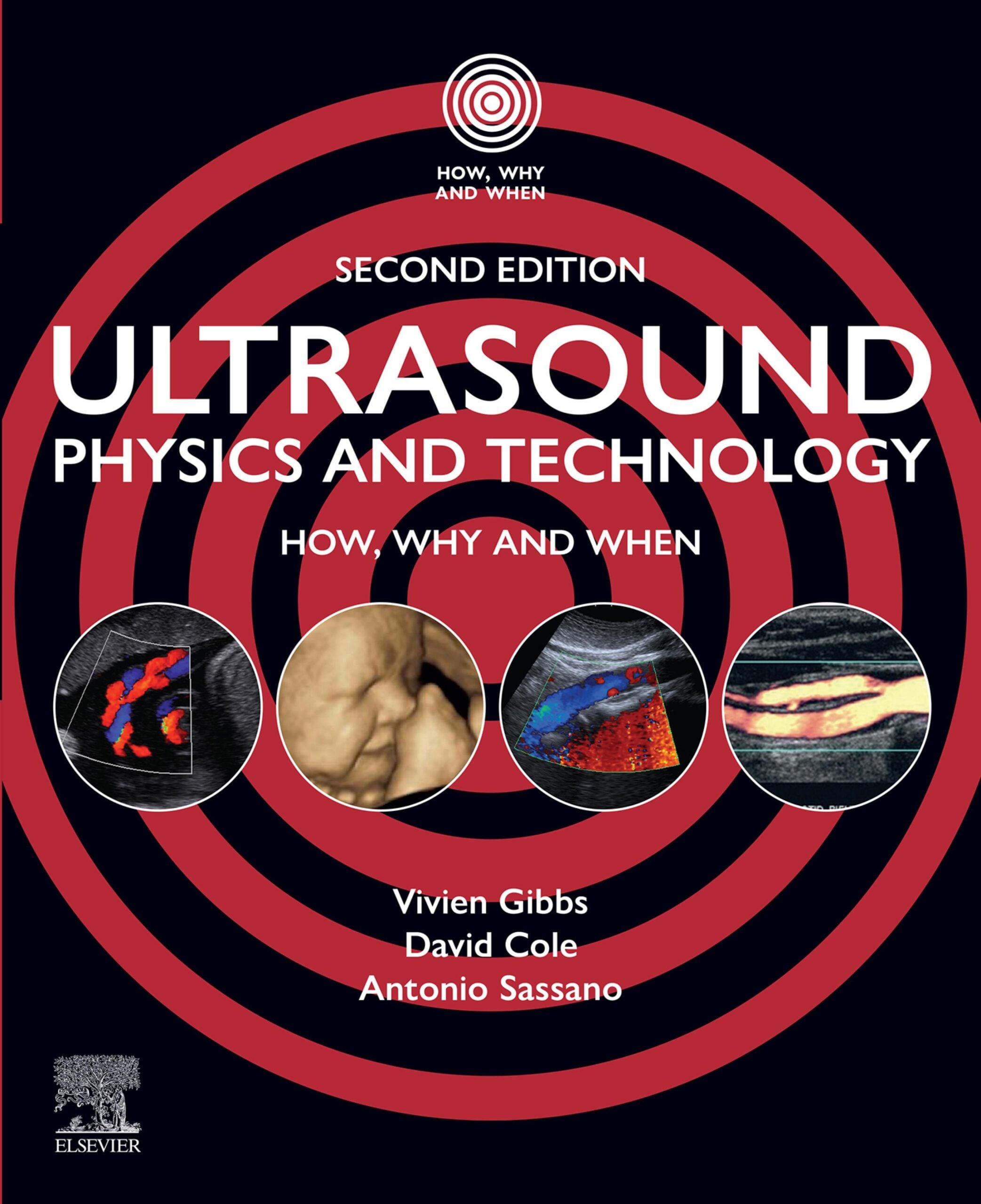 Ultrasound Physics and Technology, 2nd Edition (EPUB) Ultrasound Physics and Technology, 2nd Edition (EPUB)