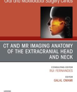 CT and MR Imaging Anatomy of the Extracranial Head and Neck, An Issue of Oral and Maxillofacial Surgery Clinics of North America (EPUB)