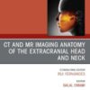 CT and MR Imaging Anatomy of the Extracranial Head and Neck, An Issue of Oral and Maxillofacial Surgery Clinics of North America (PDF)