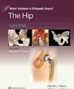 Master Techniques in Orthopaedic Surgery: The Hip, 4th Edition (EPUB)