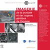 Imagerie de la prostate et des organes génitaux de l’homme(PDF)