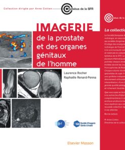 Imagerie de la prostate et des organes génitaux de l’homme(PDF)
