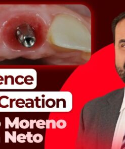 OHI-S Emergence Profile Creation Biologically Driven Implantology
