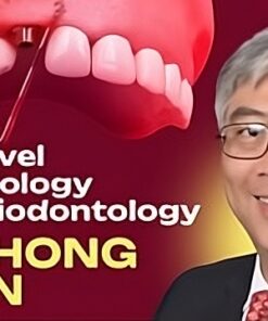OHI-S Next-Level Implantology and Periodontology Mastering Immediate Implantation, Peri-implant Soft Tissue Augmentation, Sinus Lifting