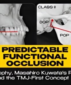 OHI-S Predictable Functional Occlusion Roth Philosophy, Masahiro Kuwata’s Protocols, and the TMJ-First Concept
