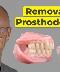 OHI-S Removable Prosthodontics Enhancing Function and Aesthetics