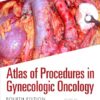 Atlas of Procedures in Gynecologic Oncology, 4th edition (PDF) Atlas of Procedures in Gynecologic Oncology, 4th edition (PDF)