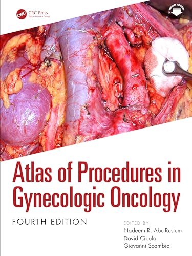 Atlas of Procedures in Gynecologic Oncology, 4th edition (PDF)